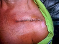 AX2009-Bodensee-Gardasee-07-Heimfahrt-021